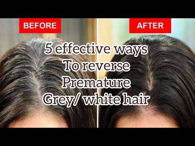 How to reverse premature grey/white hair naturally | Best remedies for premature grey hairs