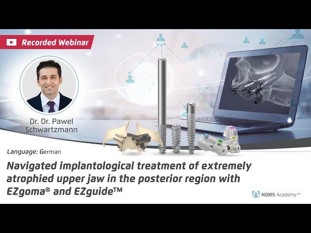 Webinar:Navigated implantological treatment of extremely atrophied upper jaw in the posterior region