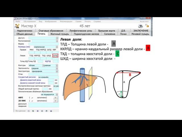 Принципы протоколирования результатов УЗИ печени
