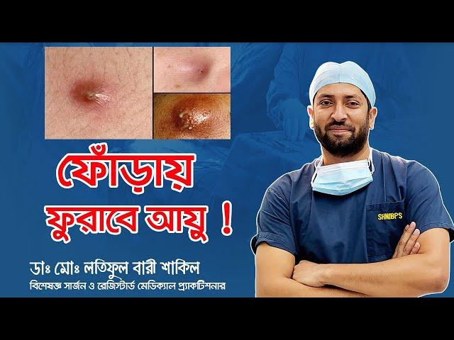 শরীরে ফোঁড়া (Abscess) হলে বা পুঁজ জমলে কী করণীয় ? । Md Latiful Bari