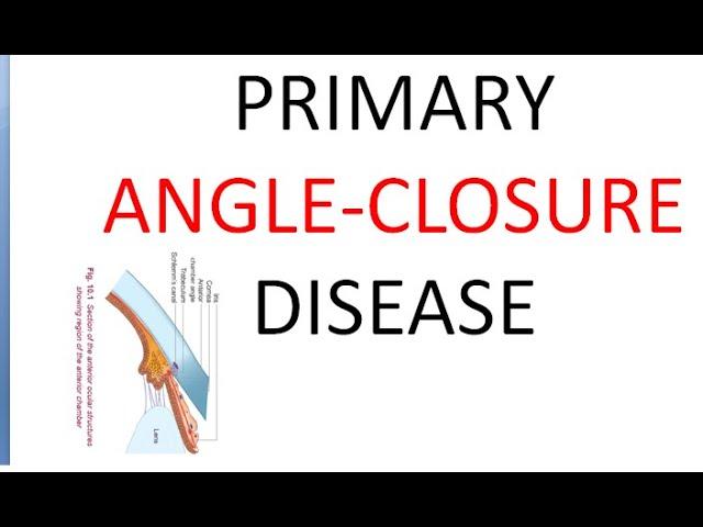 Ophthalmology Primary Angle Closure Disease Glaucoma PACG Suspect