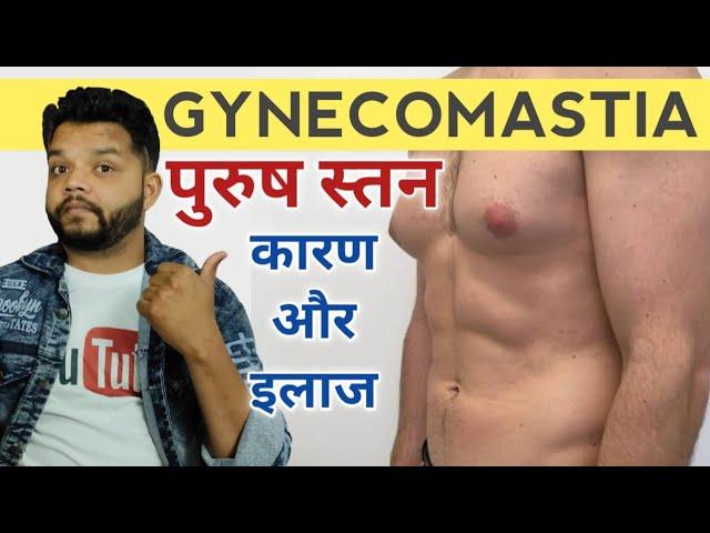 पुरुष की छाती का बढ़ना | Gynecomastia Causes And Treatment