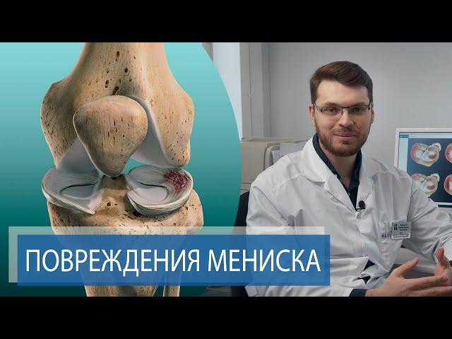 ТРАВМА МЕНИСКА | Боль и хруст в колене