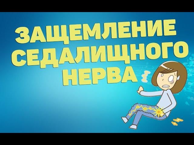 Упражнения при защемлении седалищного нерва | ЛФК