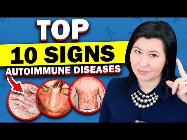 Top 10 Signs of Autoimmune Diseases - A Rheumatologist's Guide