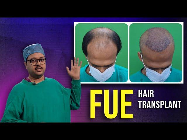 FUE Hair Transplant Kolkata || Dr  Jayanta Bain Plastic and Cosmetic Surgery