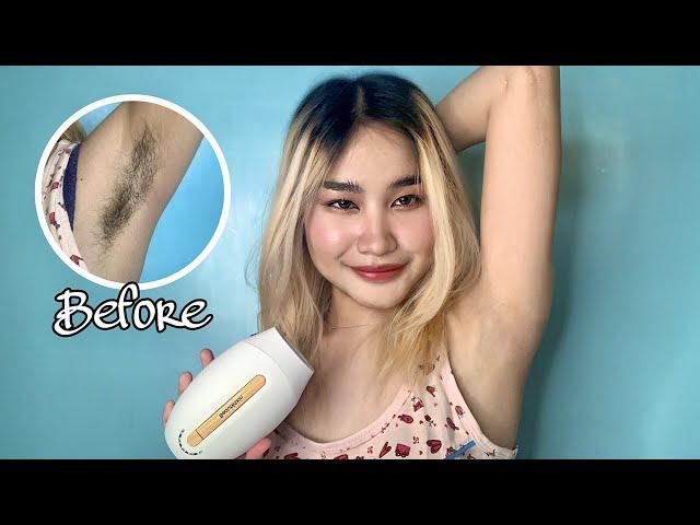 DIY KILI KILI PERMANENT HAIR REMOVAL AT HOME! (IPL) | Philippines