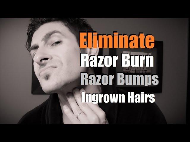 How To Eliminate Razor Burn, Bumps and Ingrown Hairs | Razor Burn Prevention