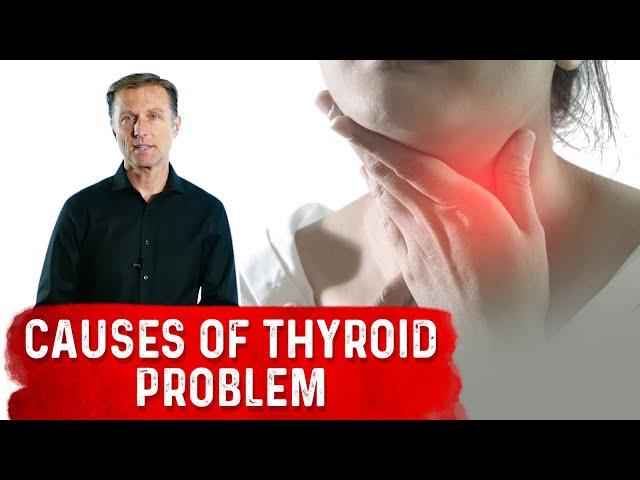 What are the Real Causes of Thyroid Problems? – Dr.Berg