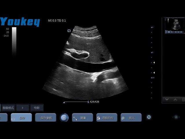 YOUKEY Wireless Ultrasound clinical images