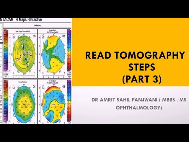 How to read corneal tomography printout || Pentacam