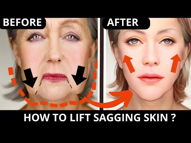  ANTI-AGING EXERCISES FOR SAGGING SKIN, JOWLS, LAUGH LINES, FOREHEAD, EYE BAGS, NECK | SUBTITLES