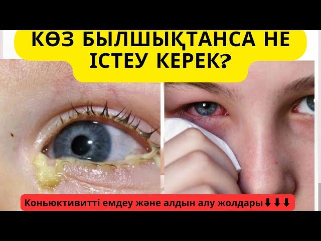 Коньюктивит | Көздің былшықтану себептері мен емдеу жолдары