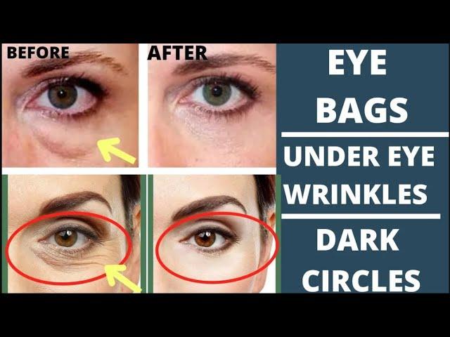 FACE YOGA FOR EYE BAGS, EYE WRINKLES, DARK CIRCLES | FACE MASSAGE for EYE BAGS