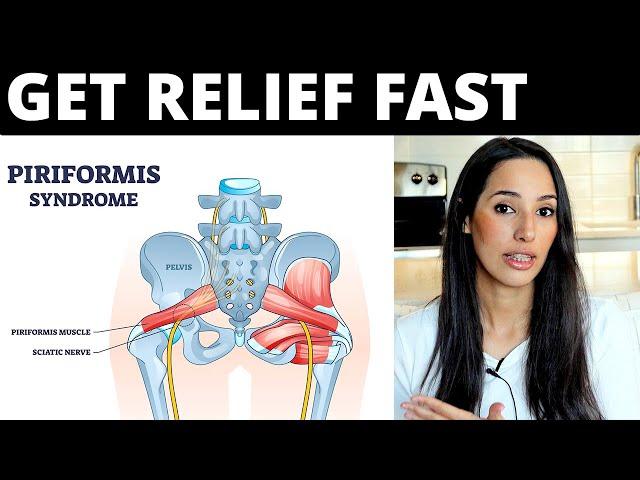 7 Piriformis Syndrome Tips to Get FAST Relief (No Exercises or Stretches)