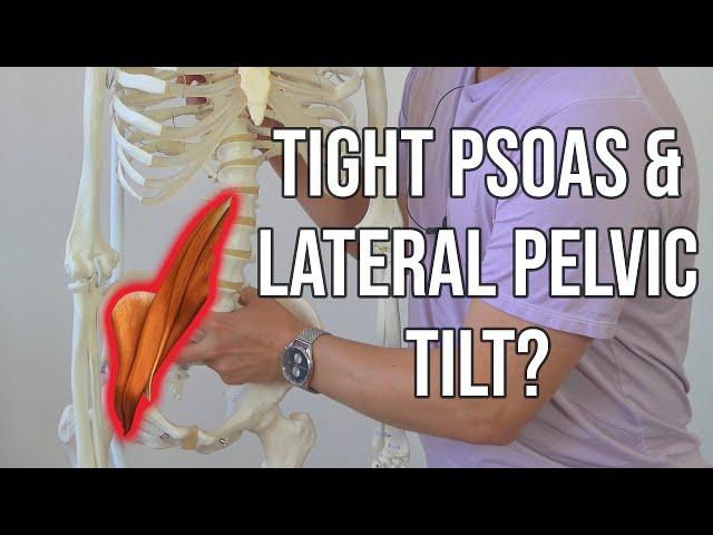 Lateral Pelvic Tilt and TIGHT PSOAS Exercises - 4-Step Progression