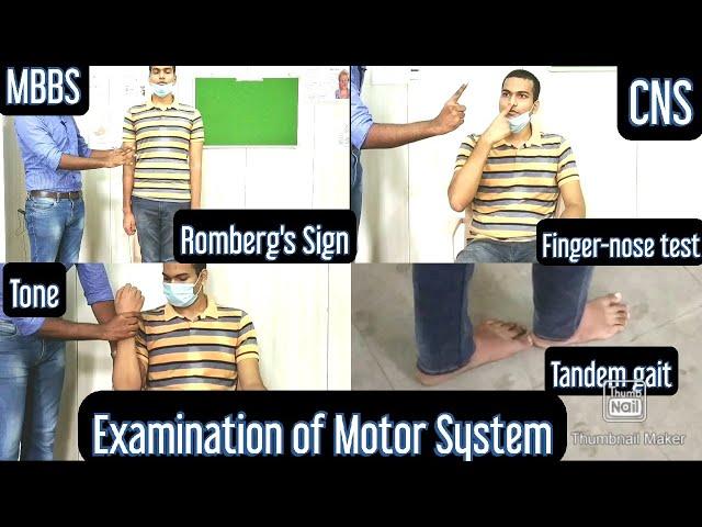 CNS - Examination of Motor system, English/Hindi, Tone, Strength, Romberg's sign, Tandem gait,