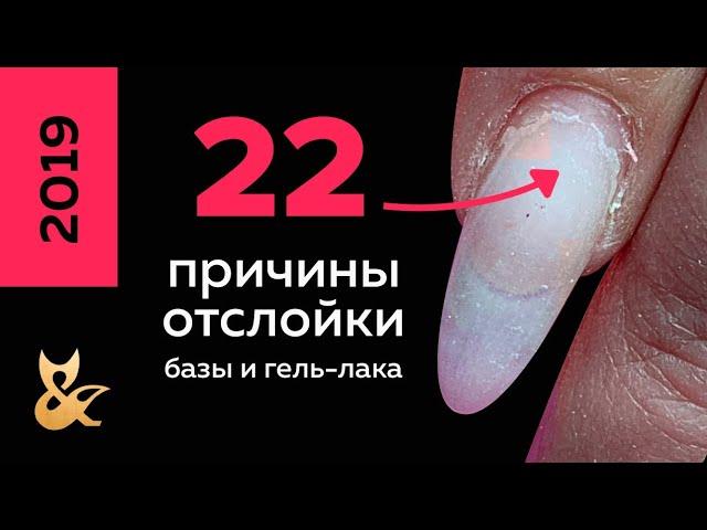 Почему не держится база и гель лак? 22 причины отслойки базы и гель-лака. Что делать?