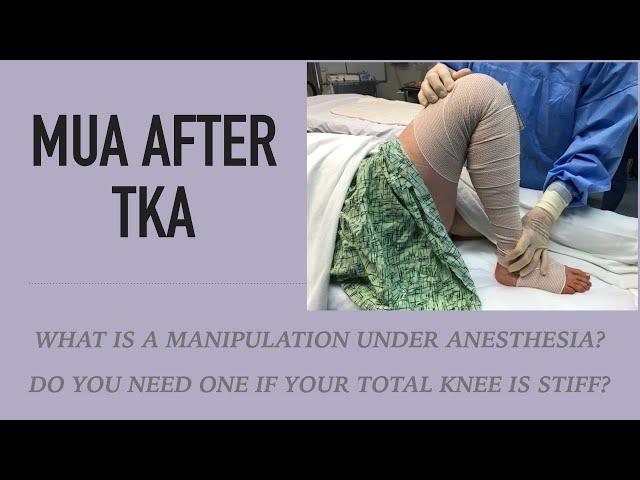 Manipulation Under Anesthesia (MUA) after Total Knee - Treatment for Stiffness