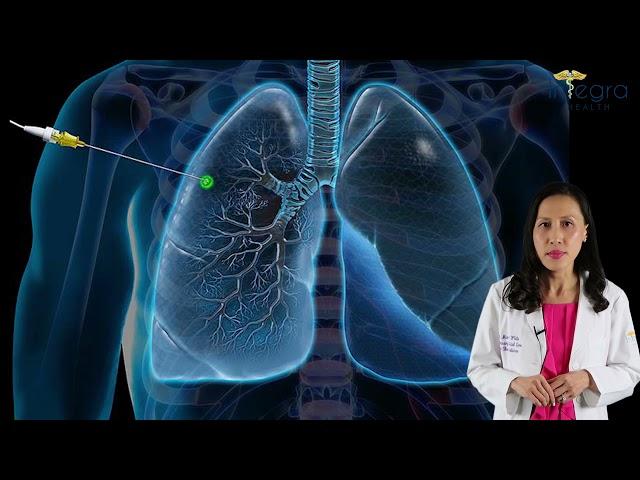 Diagnosing Lung Cancer by early identification of pulmonary nodules.