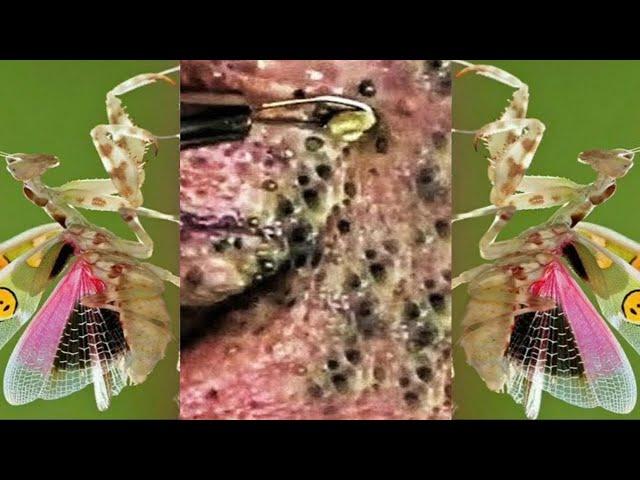 Relax squeezing out blackheads #25 Черные точки