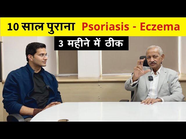 Psoriasis Eczema Treatment Ft. Dr. Mahendra Kabra | Homeopathy | Skin Disease | Himanshu Bhatt