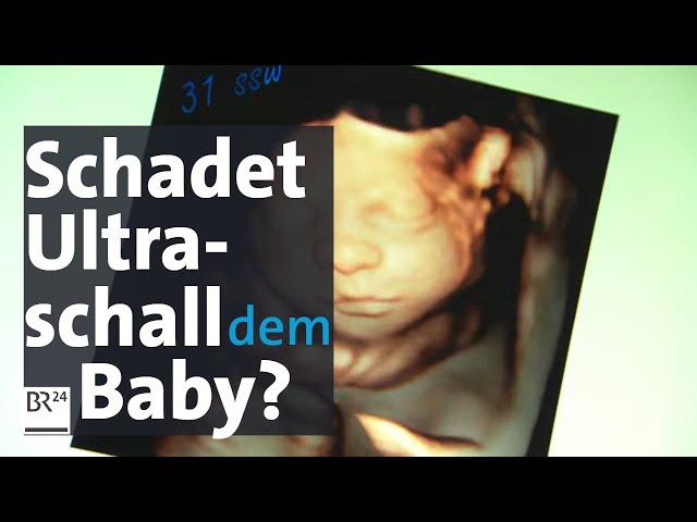 Babywatching: Wie gefährlich ist 3D-Ultraschall-Untersuchung in der Schwangerschaft für das Baby?
