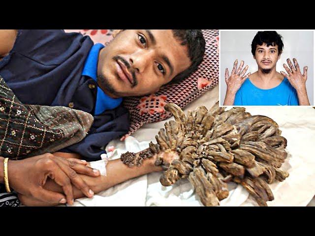 9 अनोखे लोग जिन्हे देखकर हिल गयी थी दुनिया | 9 Unique People Who Shocked the World [Hindi]