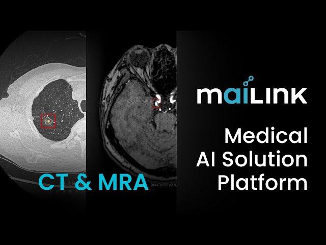 Medical AI Solution Platform : maiLink Lung/Neuro