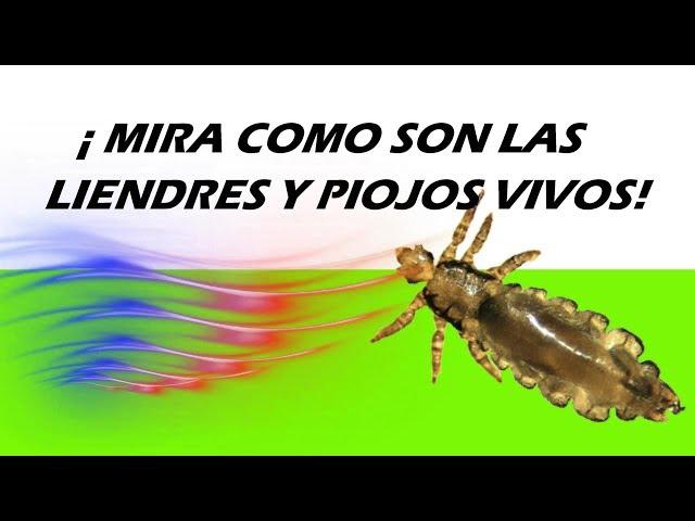 ¡MIRA COMO SON LAS LIENDRES Y PIOJOS VIVOS!