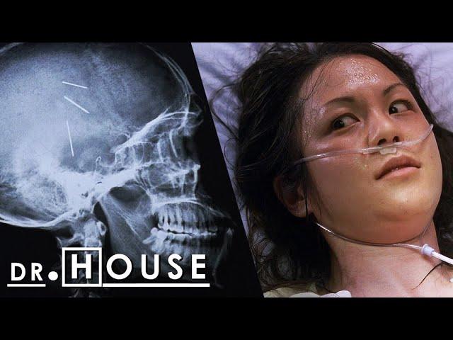 ¡Sus padres insertaron ALFILERES EN SU CEREBRO al nacer! | Dr. House: Diagnóstico Médico