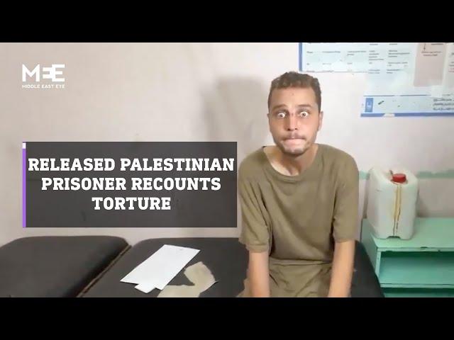 Released Palestinian prisoner in terrible condition after month-long detention
