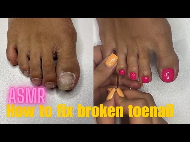 how to fix broken toenail step-by-Step | asmr pedicure cleaning