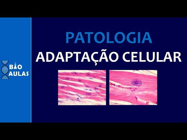 Adaptação Celular: Hipertrofia, Hiperplasia, Hipotrofia, Metaplasia (Patologia Geral) - Bio Aulas