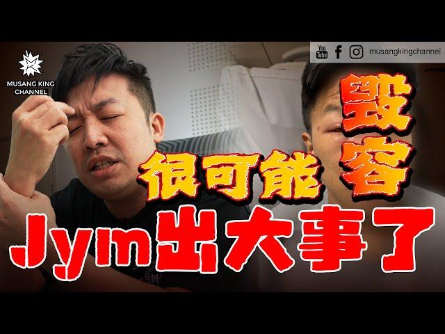 【紧急宣布】出大事了！Jym进院了，差点失明，很可能毁容！频道面对停更危机。 Emergency Declaration！