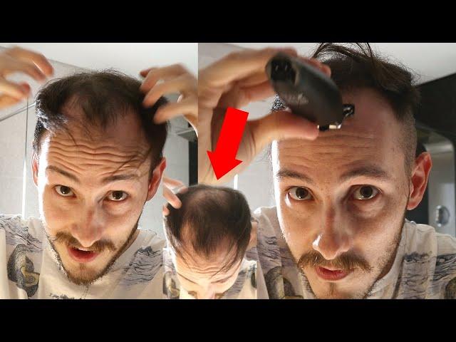 BALDING Man Shaves Head Bald TRANSFORMATION