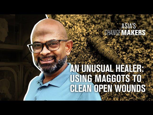 An unusual healer: Using maggots to clean open wounds