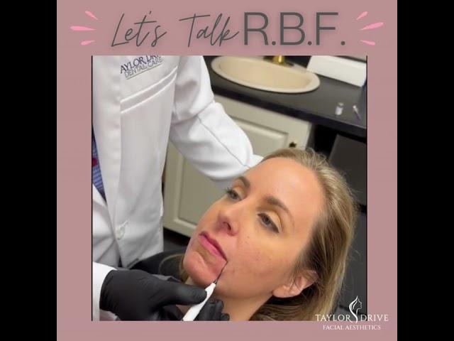 RBF - Quick, easy fix with that will make you look happier with a resting face!