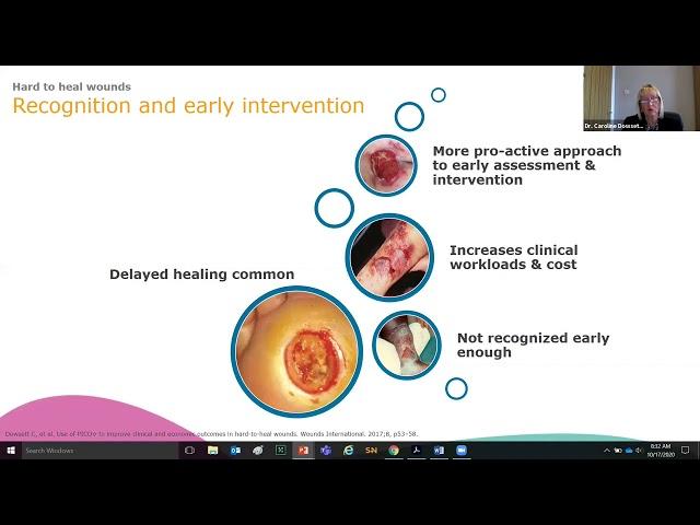 Smith + Nephew Sponsored Learning: A Route to More Effective Chronic Wound Management