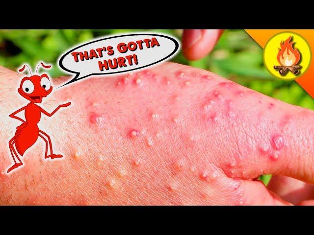 HANDS get DESTROYED by Fire Ants!