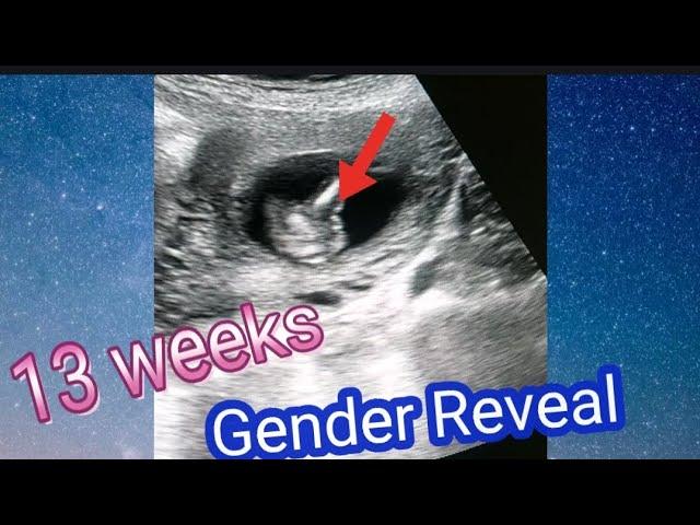 EARLIEST gender reveal ultrasound  | Anterior Placenta means baby boy /girl | Gender reveal sonogram