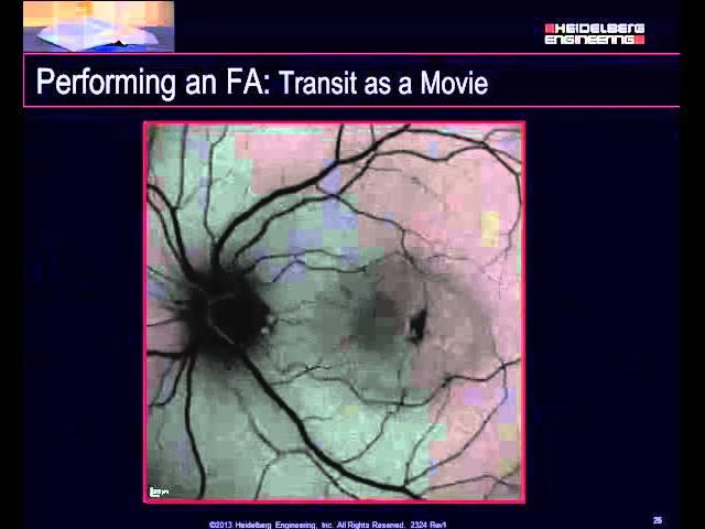 Capturing FA & ICGA Images With the SPECTRALIS®