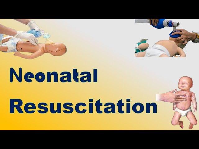 Neonatal Resuscitation | TOACS & OSCE Station