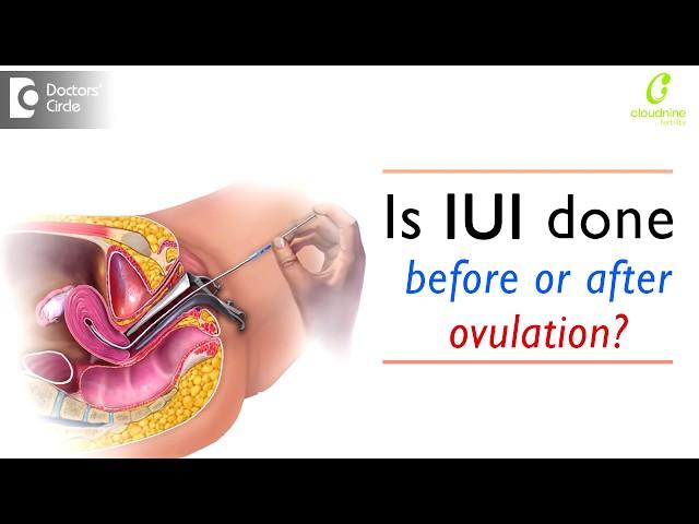 Is IUI done before or after ovulation? | Infertility Treatment - Dr. Uma Maheshwari of C9 Hospitals