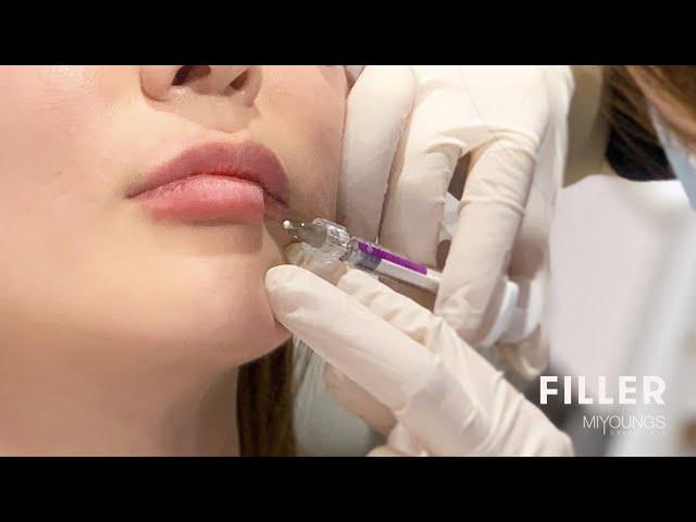 Cosmetic Injectables: dermal fillers creating natural volumised look