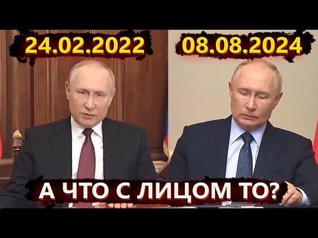 От Киева за 3 дня до санитарной зоны в Курске – Путин прервал молчание