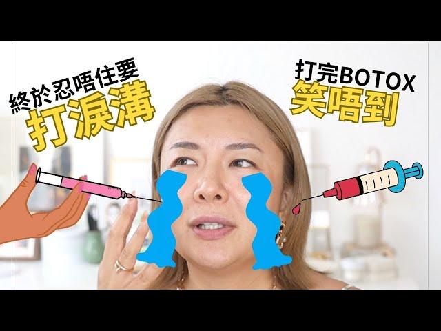 第一次醫美失敗經歷 | 公開打過針劑項目 | 水光槍vs水光針 | 打botox 瘦面咀嚼肌 | 填充淚溝 | ￼嘴唇filler