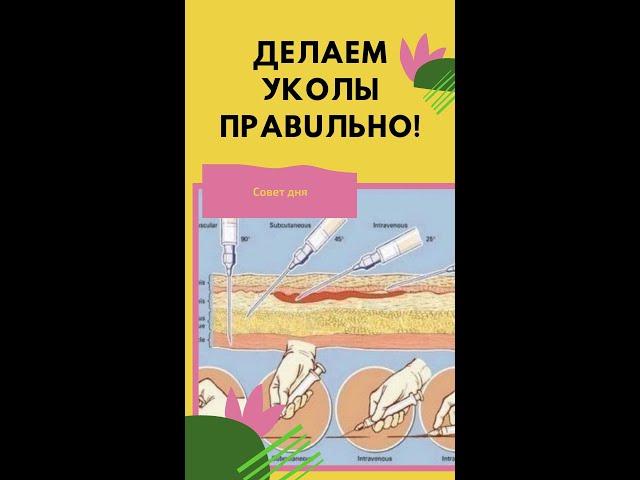 Как делать внутримышечный укол в ягодицу. Как делать уколы в ягодичную мышцу. Укол внутримышечный