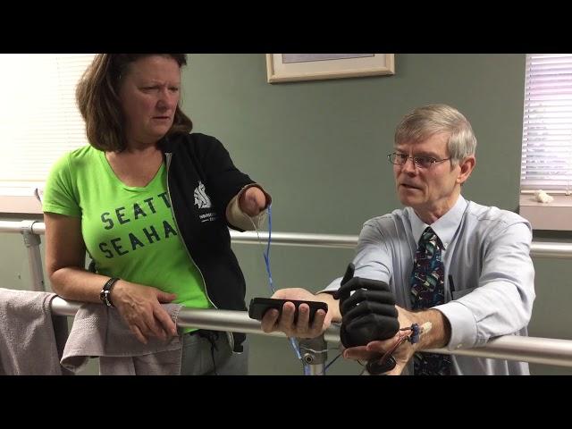 First Bionic Hand Moments from Cornerstone Patient