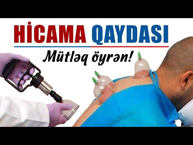 HİCAMA QAYDASI - Qan çıxarma ilə müalicə olunmağın yolunu öyrən! Min dərdin dəvasıdır!| tövbəzamanı